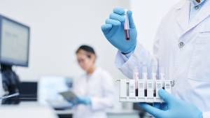 Preanalytical process in laboratory